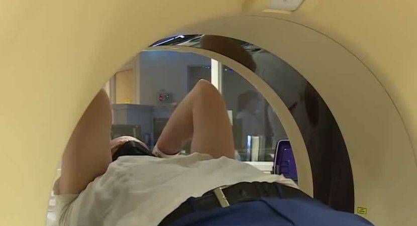 How an Upright MRI Brain Scan help to Improve Your Health?